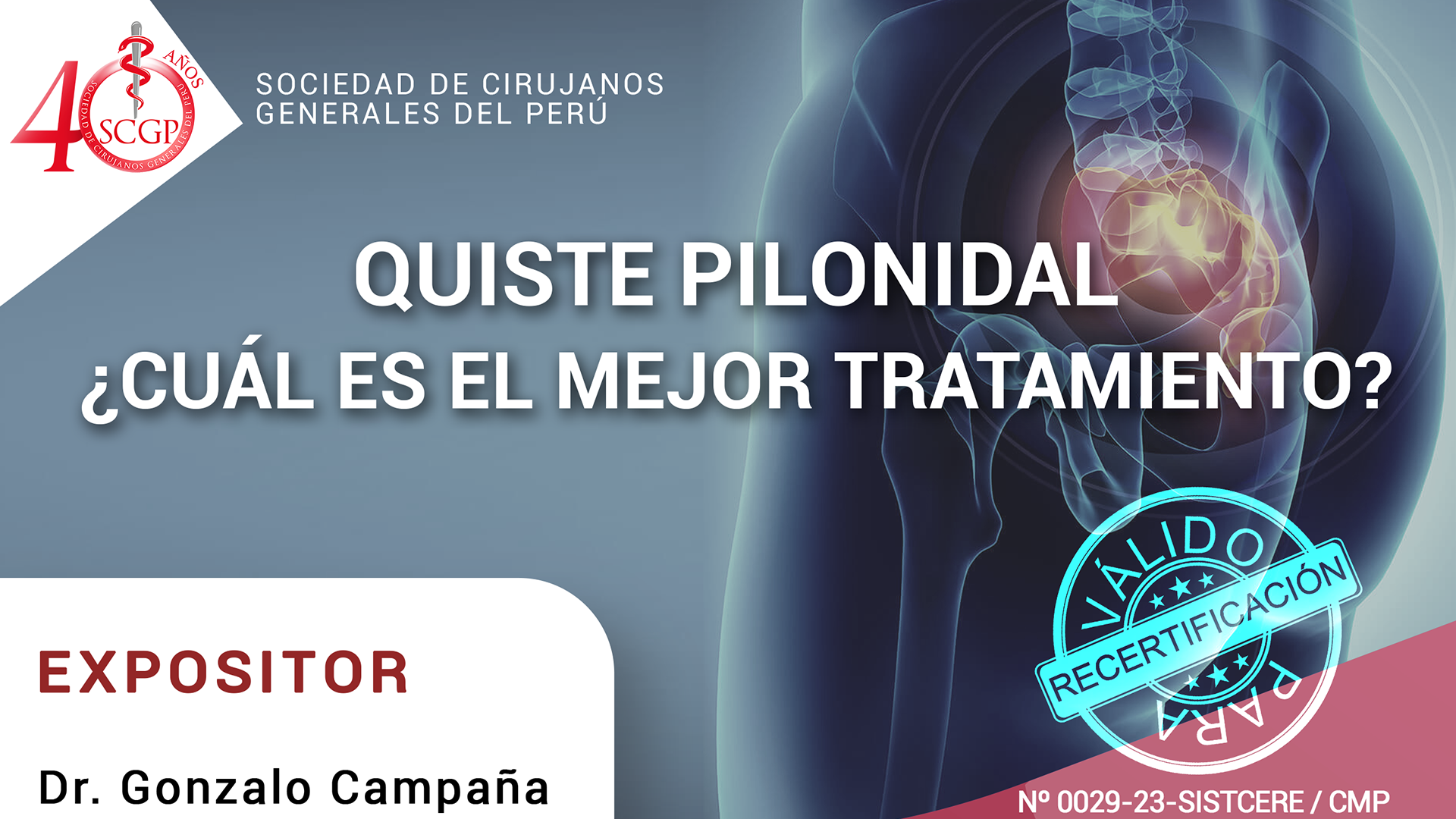 QUISTE PILONIDAL CUÁL ES EL MEJOR TRATAMIENTO