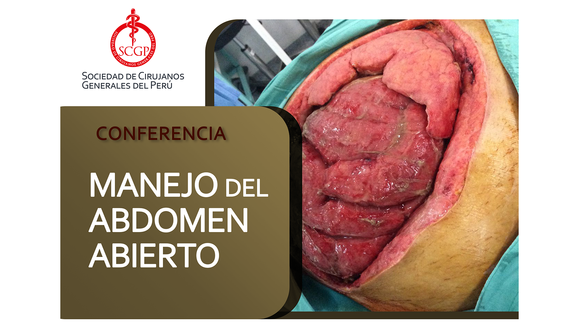 YOUTUBE 25 FEBRERO