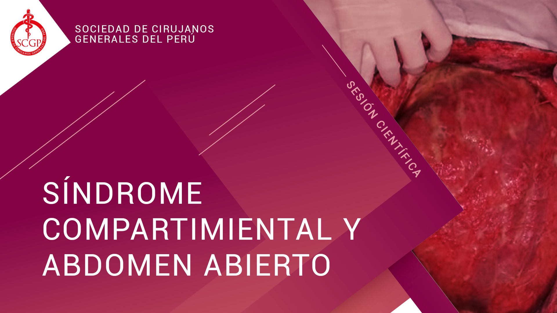 YOUTUBE 11 MAYO