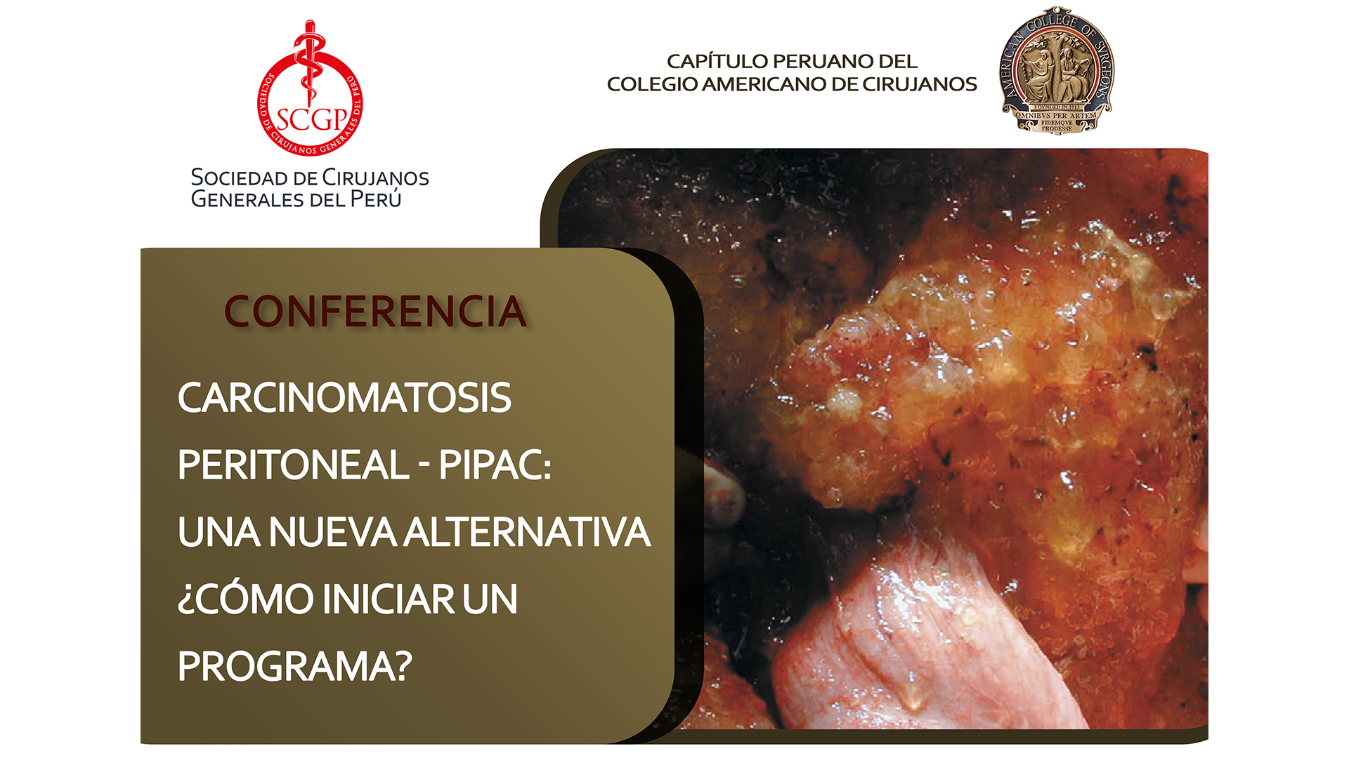 YOUTUBE 27 MAYO