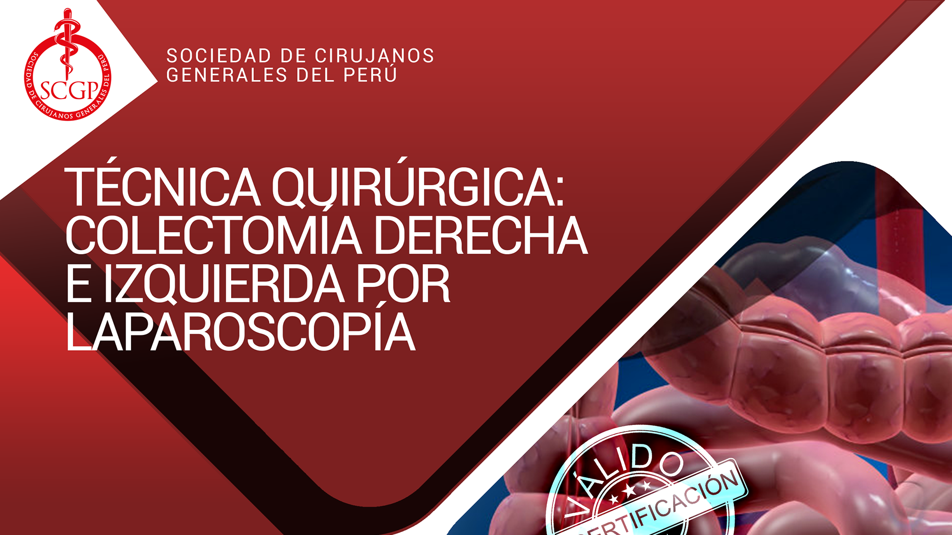 YOUTUBE SCGP 12 de Abril 2022