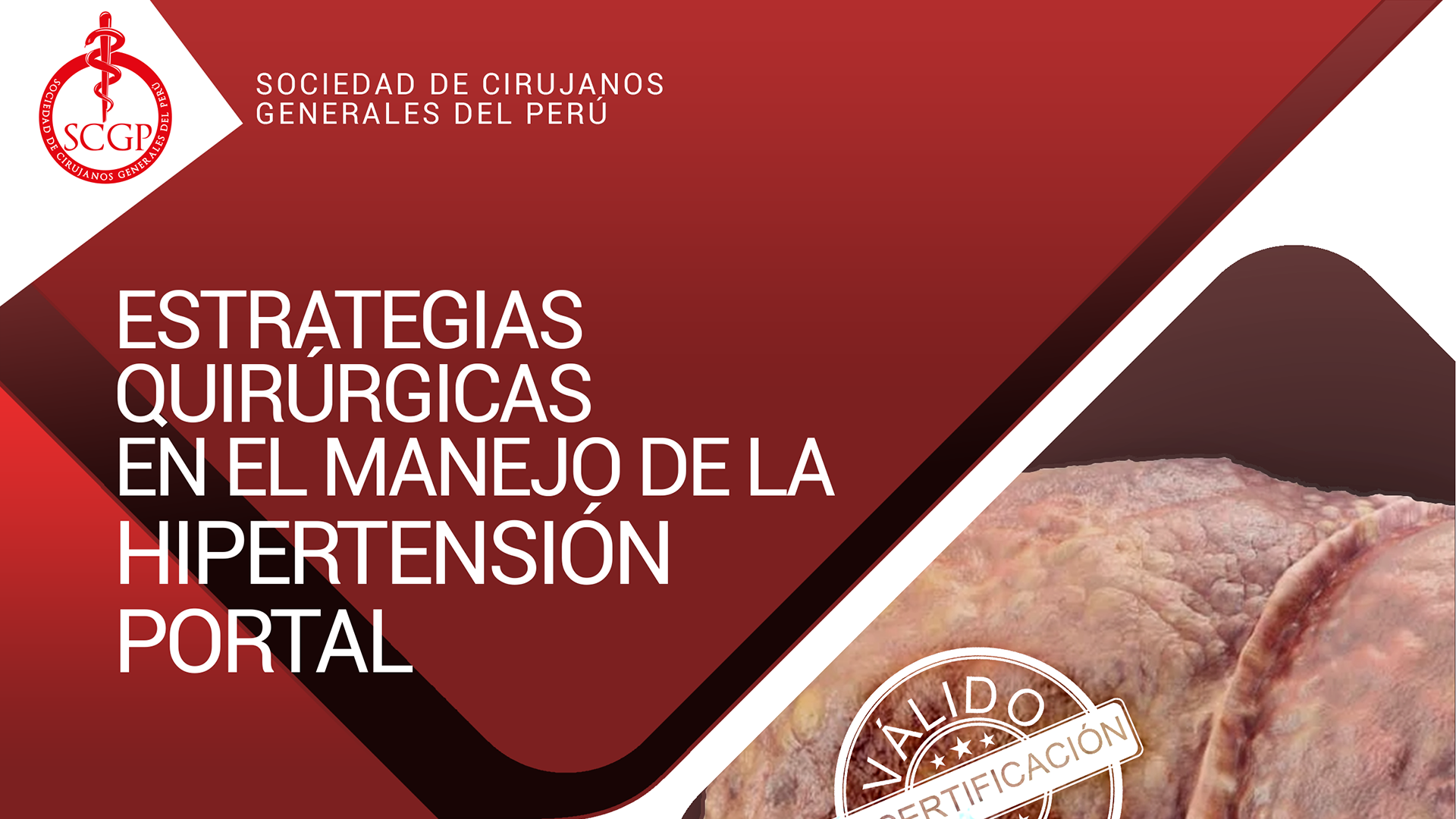 YOUTUBE SCGP martes 10 de mayo 2022