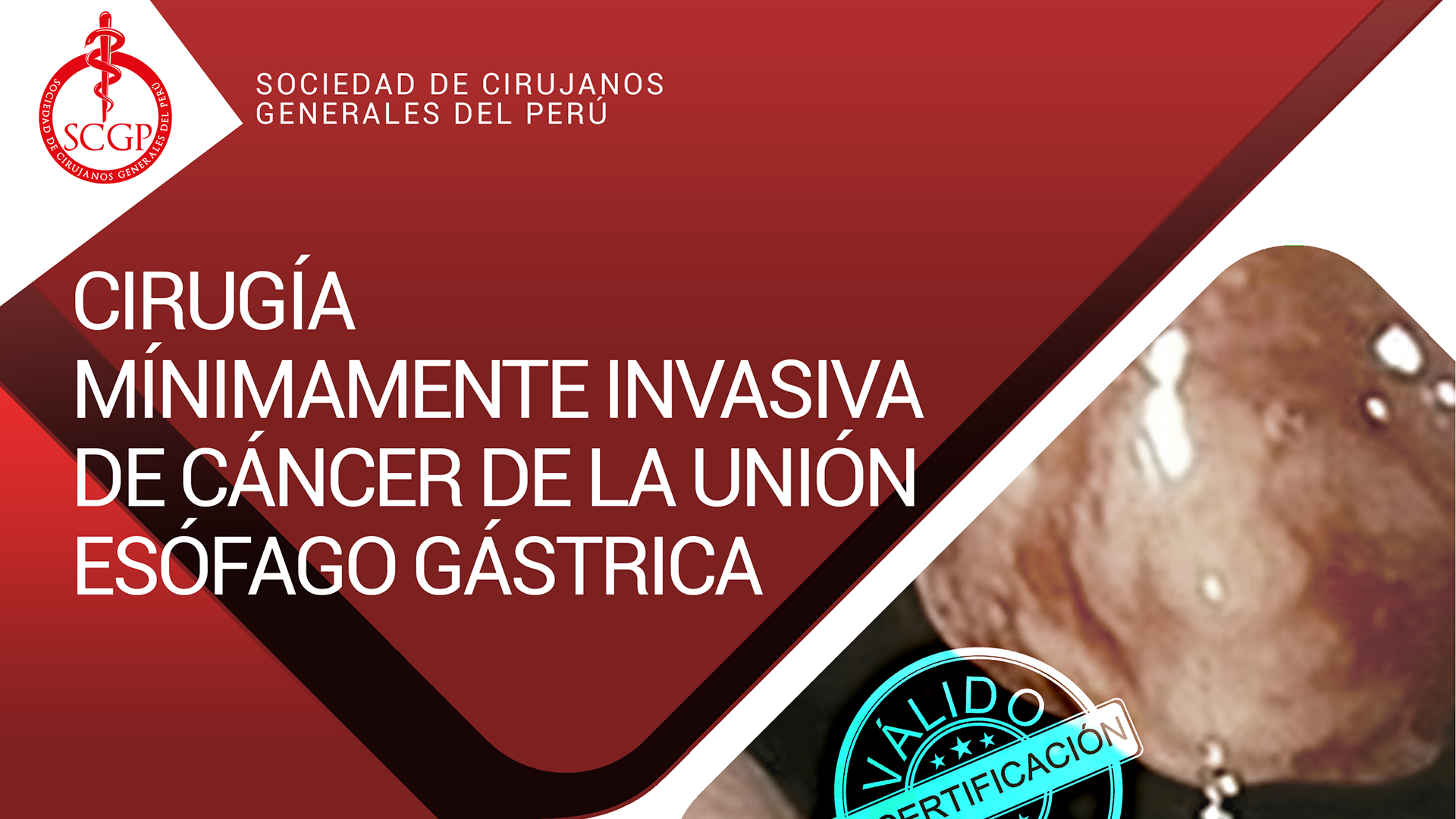 YOUTUBE SCGP 14 de junio 2022