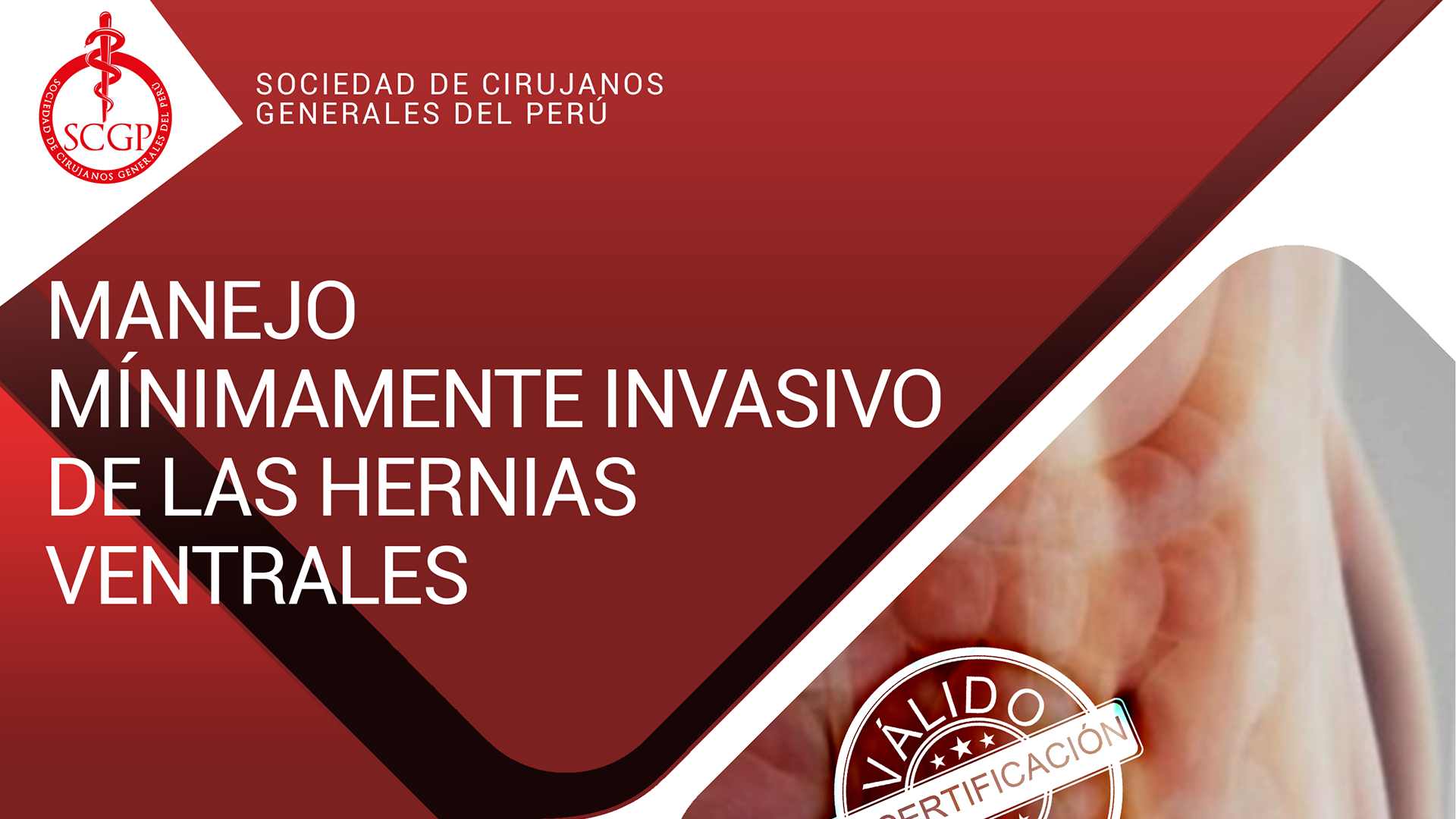 YOUTUBE SCGP martes 12 julio 2022