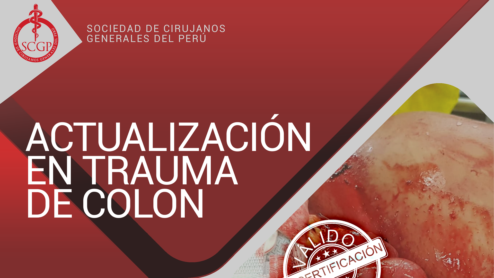 YOUTUBE SCGP 11 octubre 2022