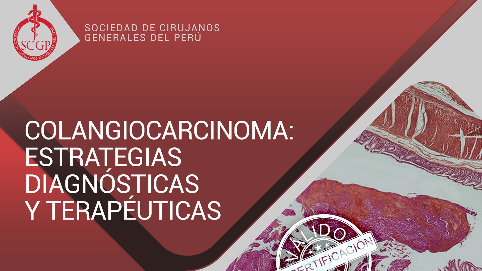 YOUTUBE SCGP 8 noviembre 2022