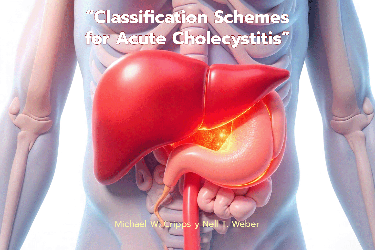 Classification Schemes for Acute Cholecystitis