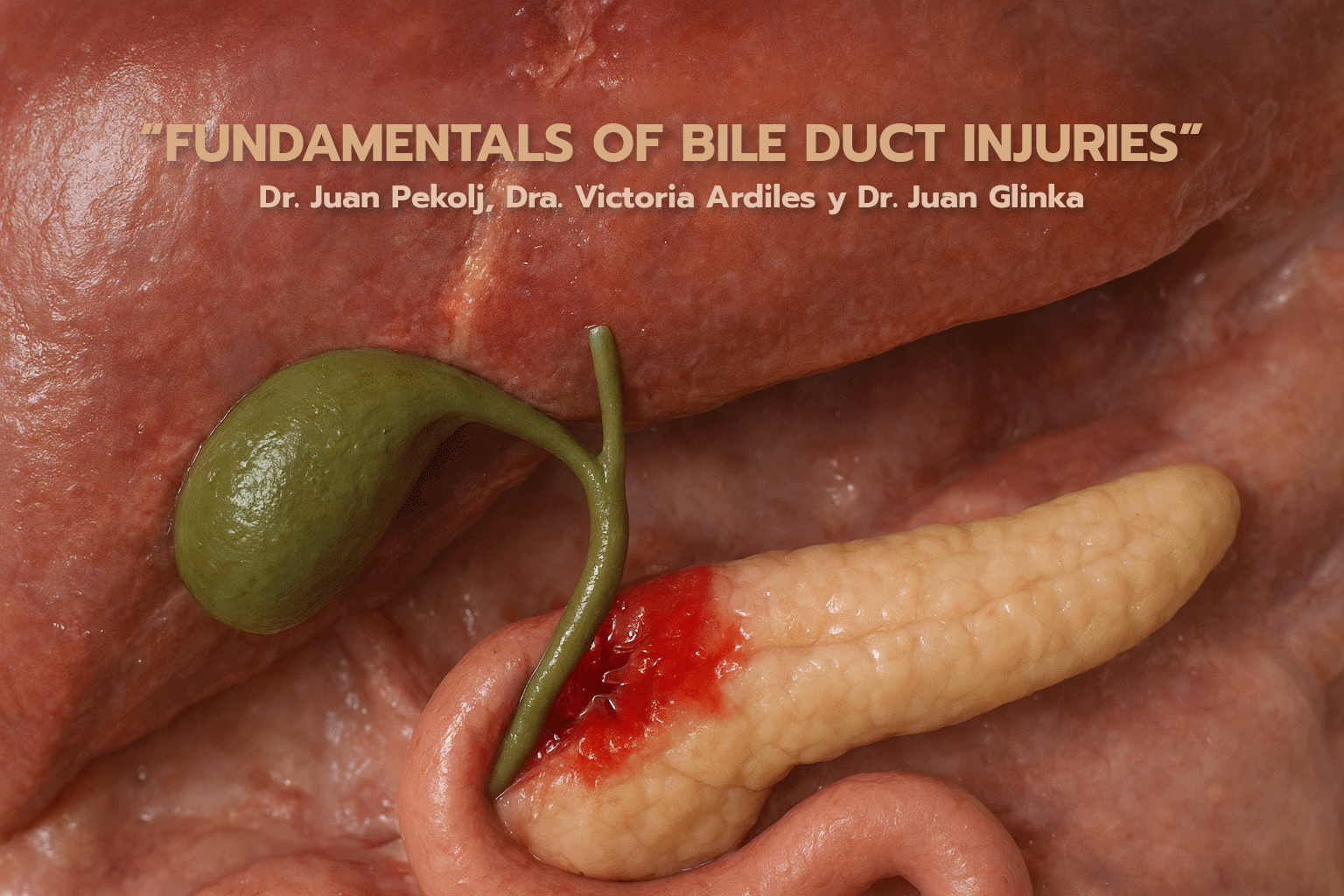 “FUNDAMENTALS OF BILE DUCT INJURIES”